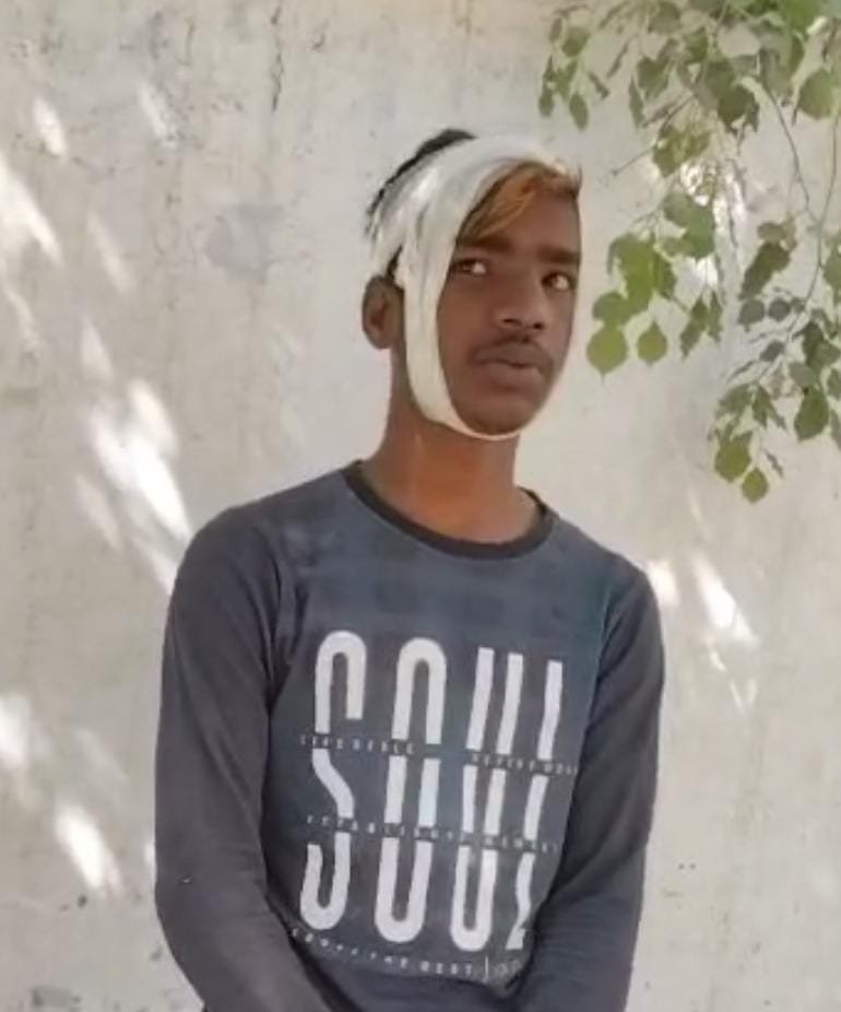 रायबरेली-डेरी पर दूध देने जा रहे युवक को गांव के एक दबंग ने सर पे मारकर किया घायल