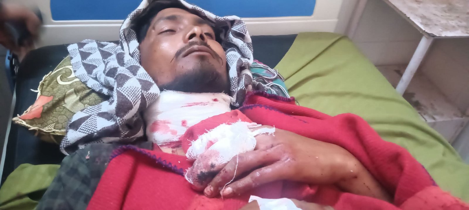 रायबरेली में 'कातिल' चाइनीज मांझे का तांडव: बाइक सवार युवक का कटा गला, हालत नाजुक होने पर लखनऊ रेफर