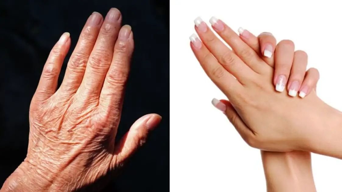 हाथों में झुर्रिया देख लोग समझ न ले बूढ़ा करे ये उपाय!
