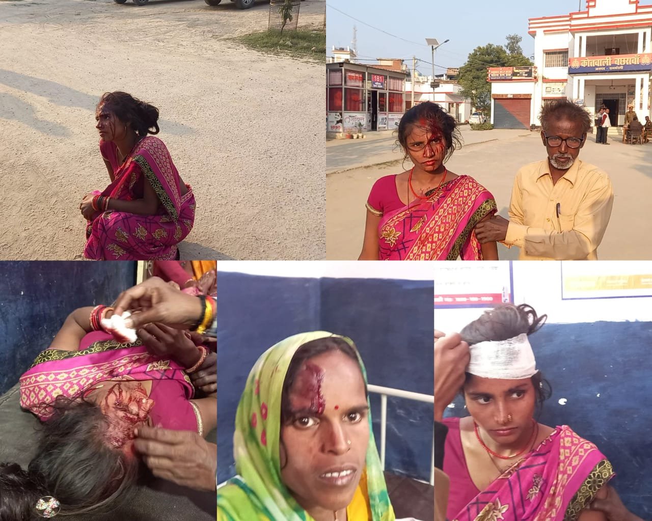 Raebareli:बच्चों के विवाद में दो पक्षों में खूनी संघर्ष में दो महिलाएं घायल