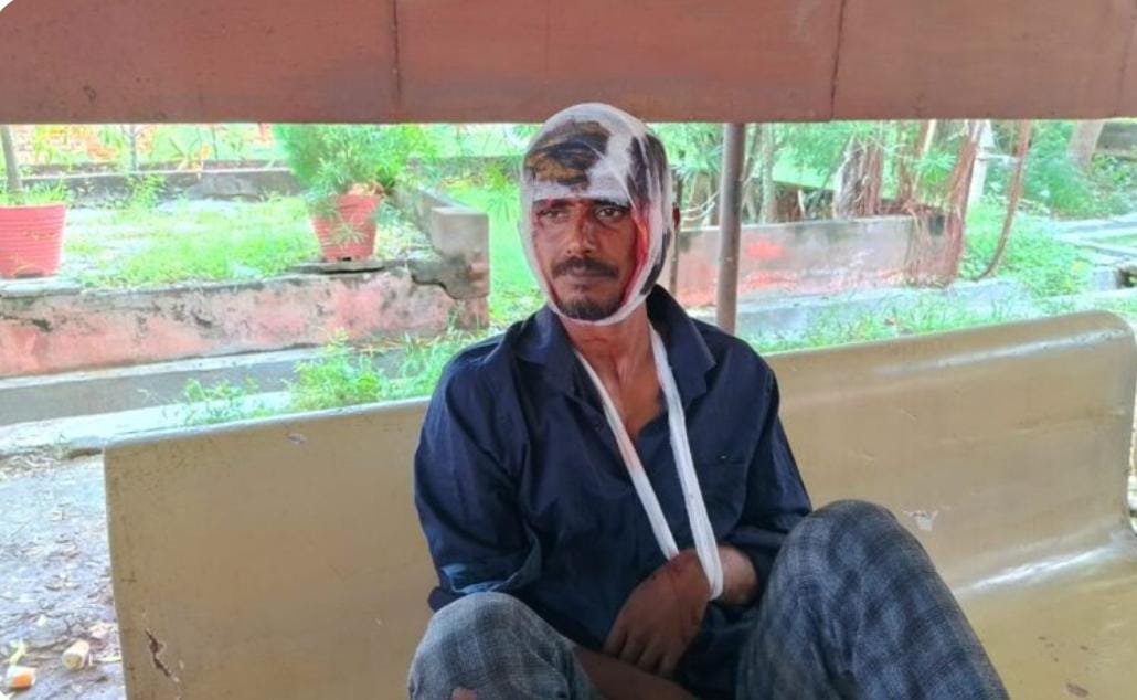 Raibareli-ट्रक चालक की लापरवाही से युवक हुआ घायल ,जिला अस्पताल रेफर।