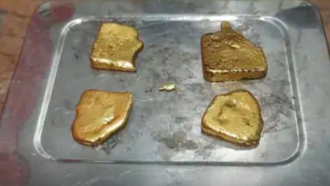 प्राइवेट पार्ट में एक किलो सोना ला रहा था, एयरपोर्ट अफसरों ने पकड़ा तो अस्पताल ले जाकर निकलवाया