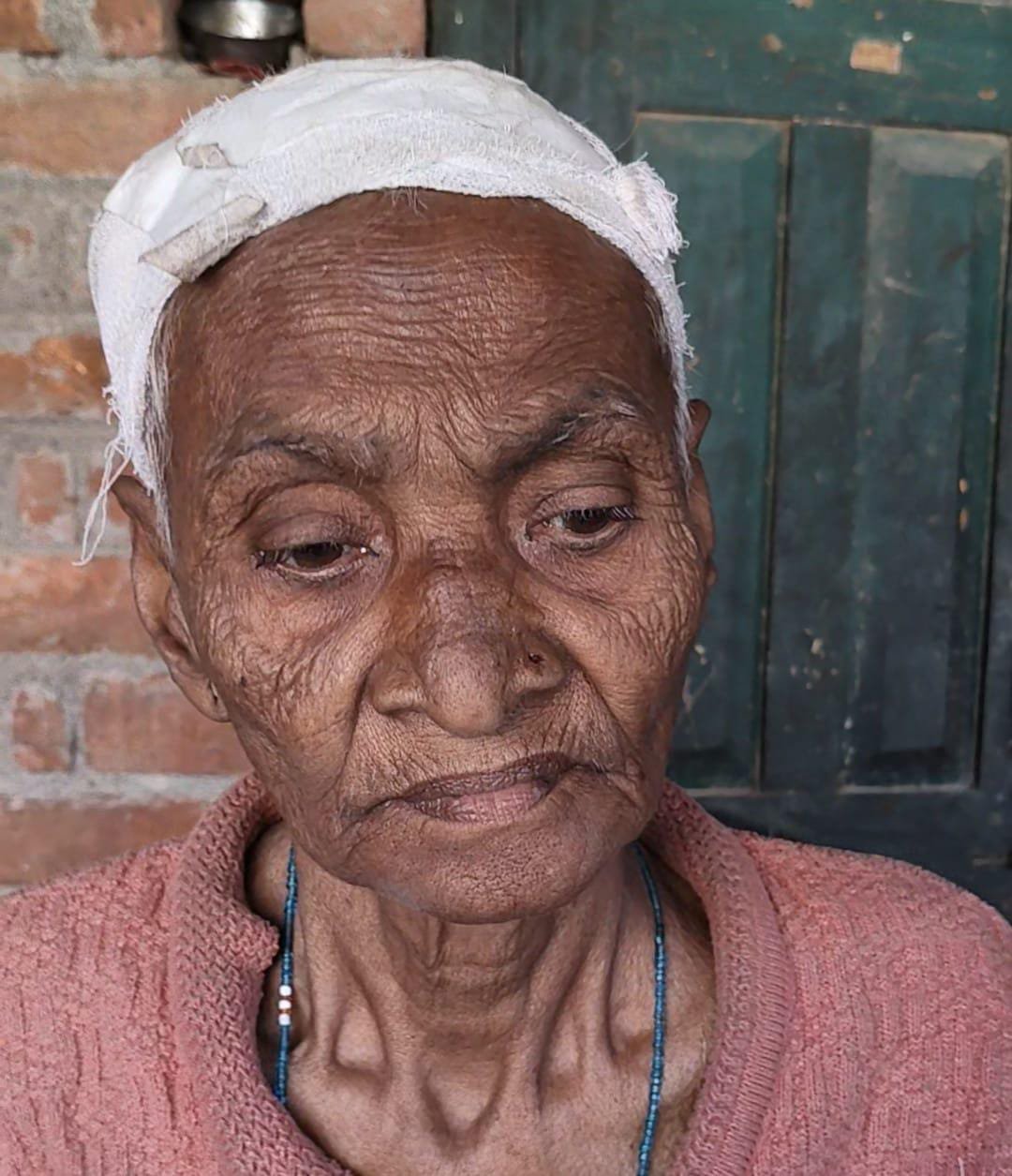 रायबरेली-मारपीट में घायल बुजुर्ग के इलाज में बरती जा रही लापरवाही, पुलिस लगाये आरोप