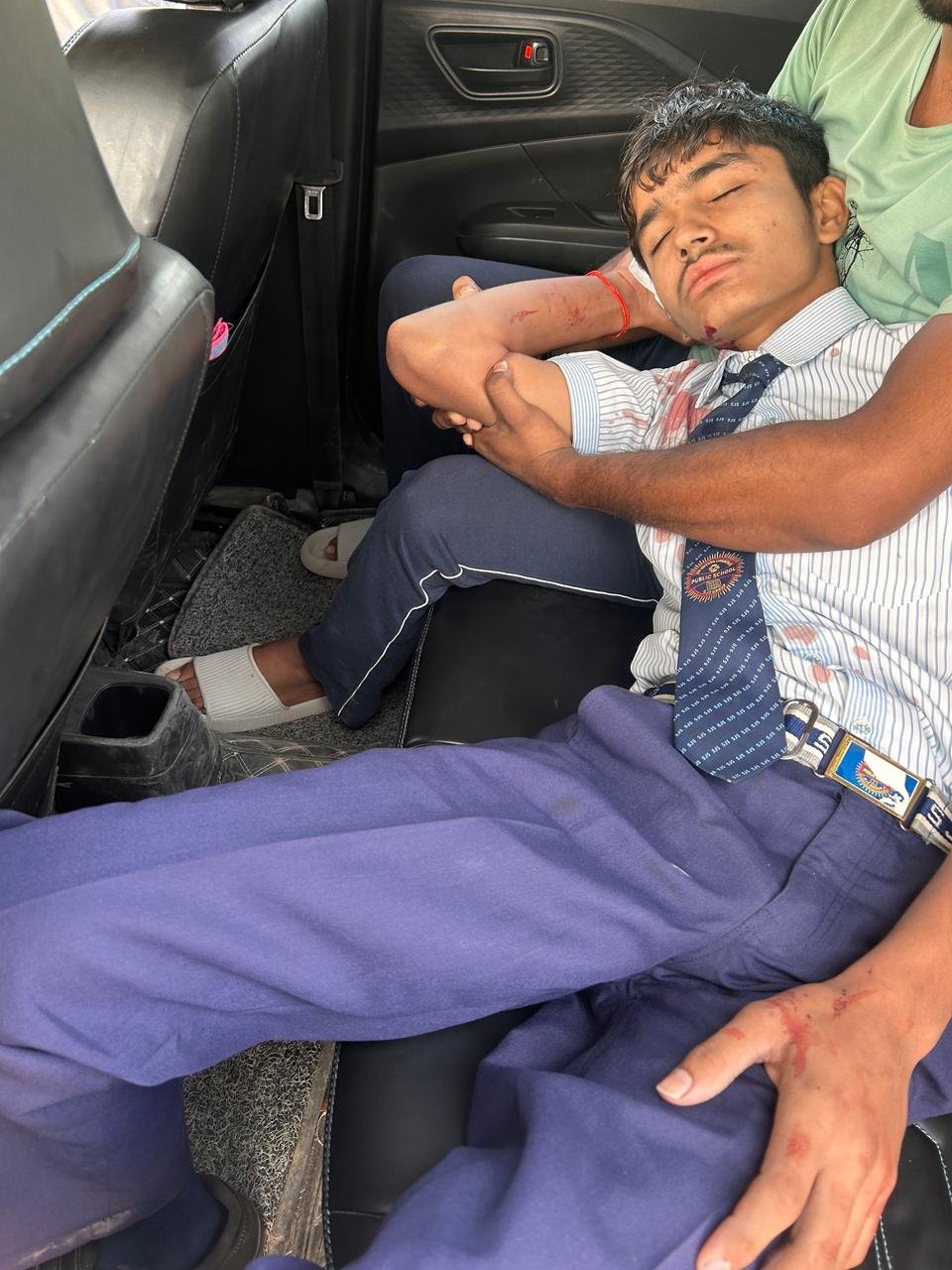 रायबरेली-कालेज जा रहे इंटर के छात्र पर धारदार हथियार से हमला , हालत गंभीर