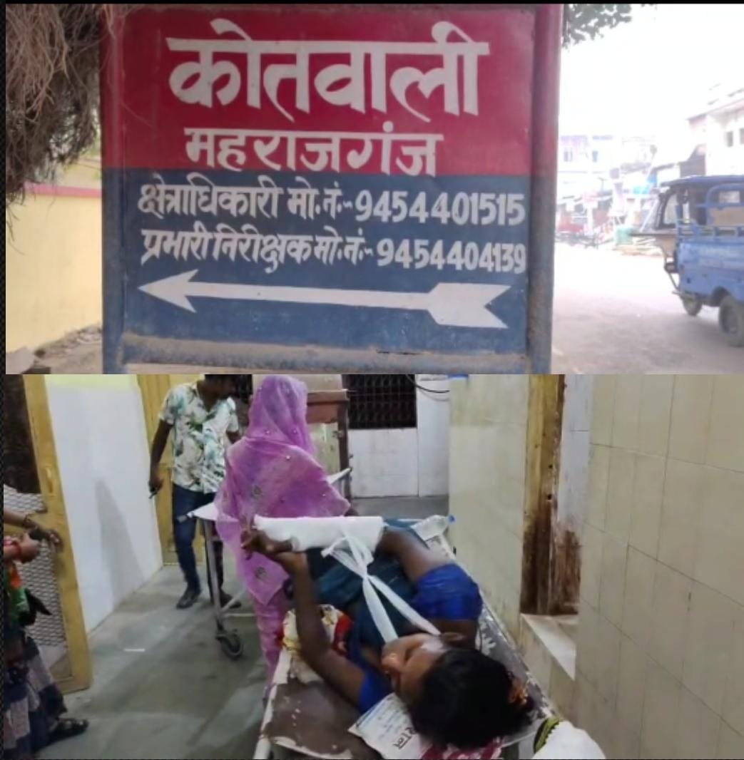 रायबरेली-पारिवारिक विवाद में देवर ने भाभी को मारपीट कर किया घायल जिसमें भाभी का दाया हाथ फैक्चर हो गया