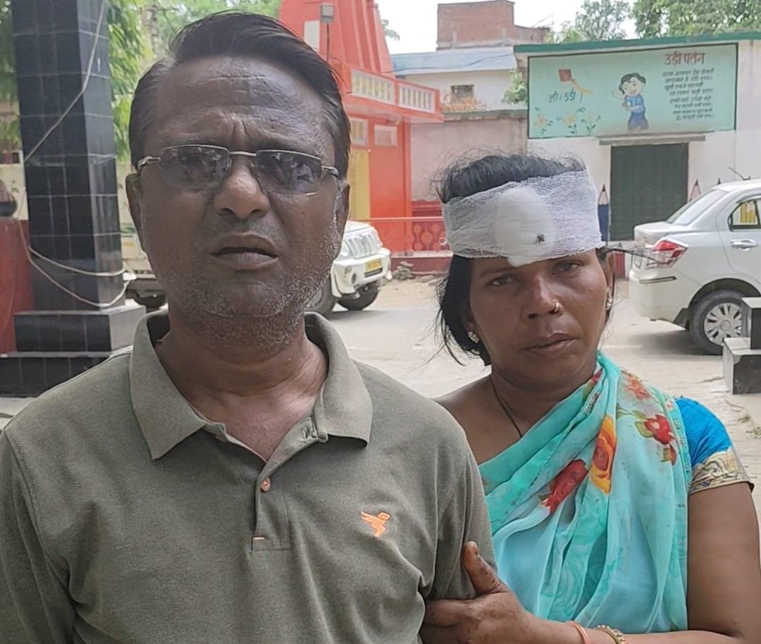 रायबरेली-बच्चों के विवाद को लेकर दो महिलाओं के बीच हिंसक झड़प, महिला घायल