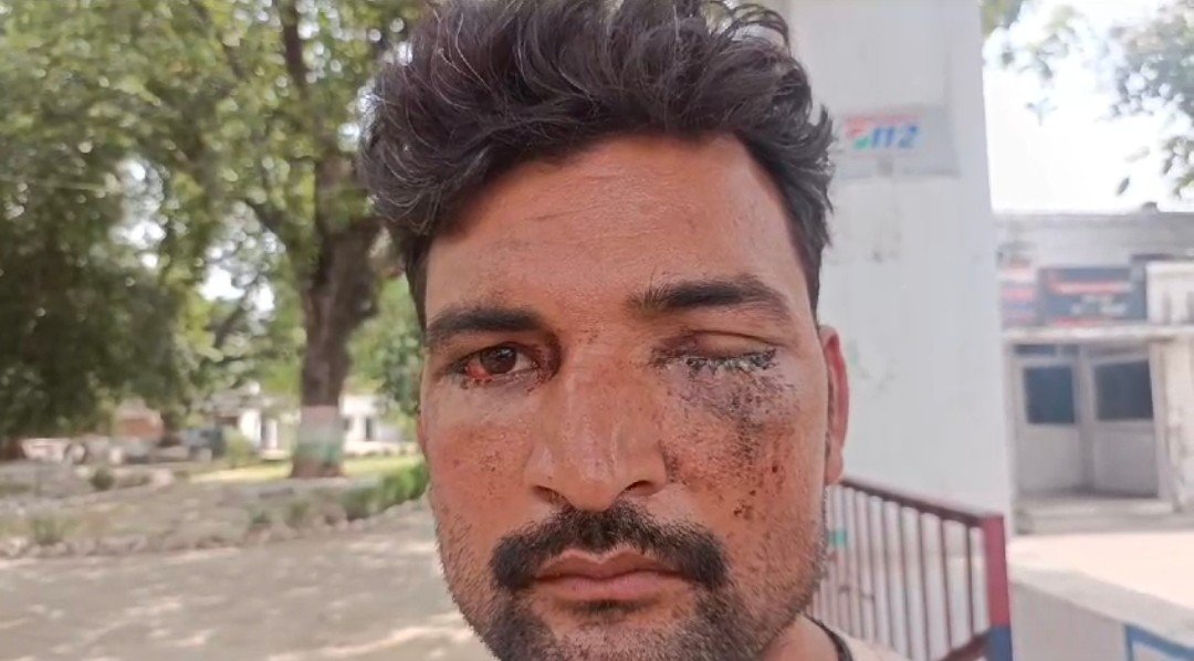 Raibareli-भाई बना भाई का दुश्मन वारदात को दिया अंजाम