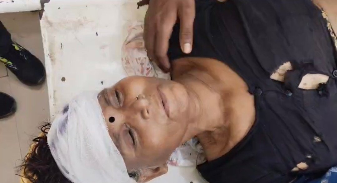 रायबरेली- ट्रेन की चपेट में आने से महिला घायल