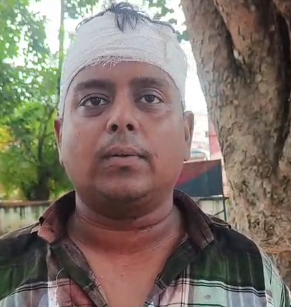 रायबरेली-एक हर्बल प्रोडक्ट विक्रेता के साथ दर्जनों लोगों द्वारा मारपीट कर मोबाईल स्कूटी छीनकर भागने का आरोप