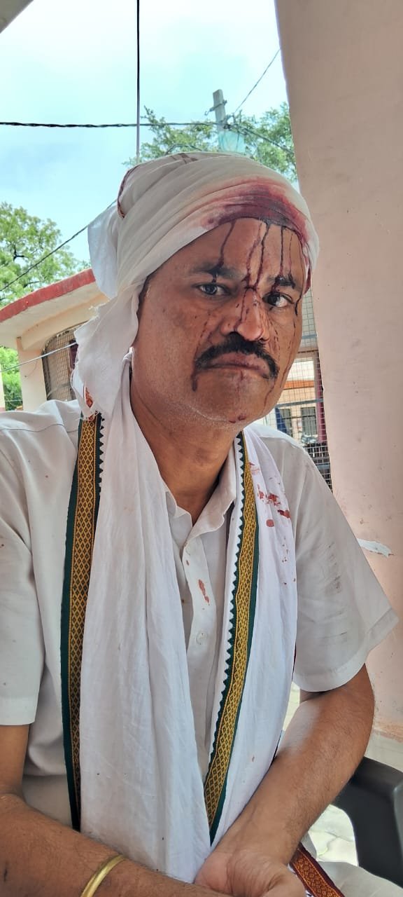 Raibareli-जान बचाकर भागे जीजा पहुंचे अस्पताल हुआ उपचार पुलिस ने लिया संज्ञान दर्ज हुआ एफआईआर