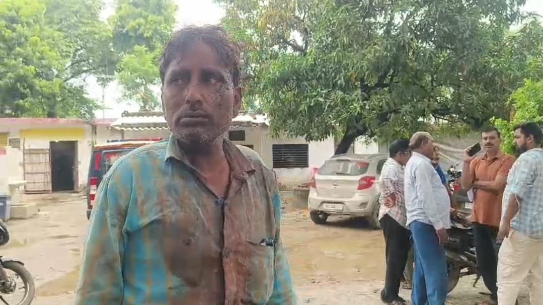 रायबरेली- सिर्फ नमस्ते करने पर छोटे भाई ने बड़े भाई पर ईंट से किया हमला घायल