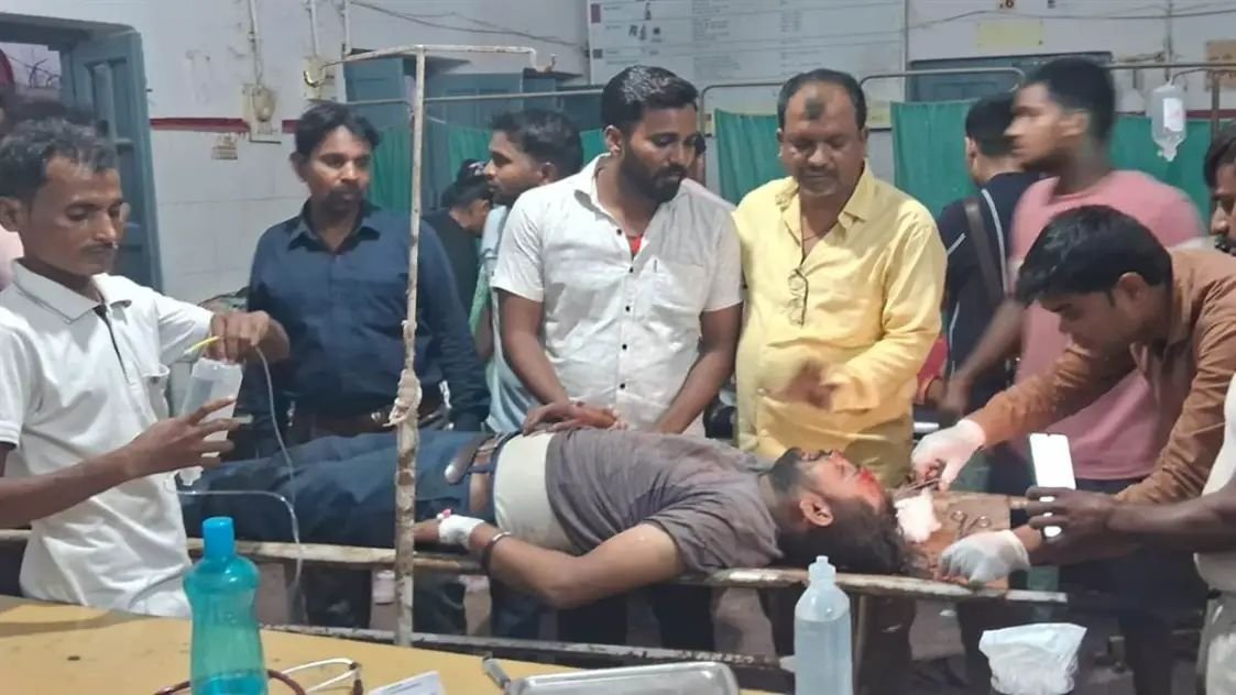 रायबरेली में टेंट हटाते समय एचटी लाइन में छुआ पाइप, मूर्ति विसर्जन के बाद हुई घटना में दाे झुलसे