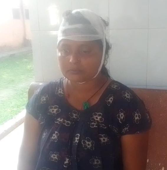 रायबरेली-पारिवारिक विवाद में एक महिला का फोडा़ सर,,, 