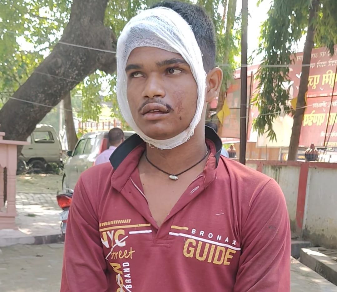 रायबरेली-फूफा के साथ घर से निकला युवक मार्ग दुर्घटना में घायल,,, 