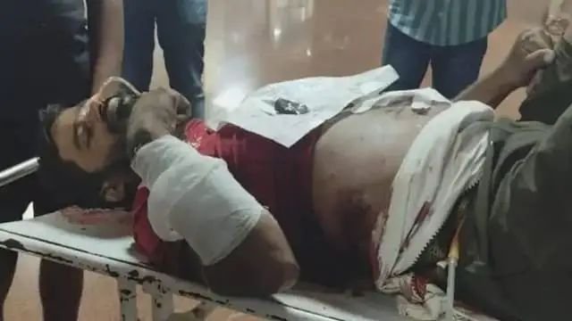 दिवाली पर लखनऊ में खूनी संघर्ष, दो पक्षों में पथराव के बाद चली गोली, 9 लोग घायल