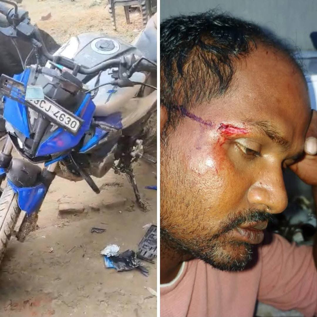 रायबरेली-दबंगों ने घर में घुस कर लाठी डंडों से मारपीटा, नहीं दर्ज हो रहा मुकदमा,,, 