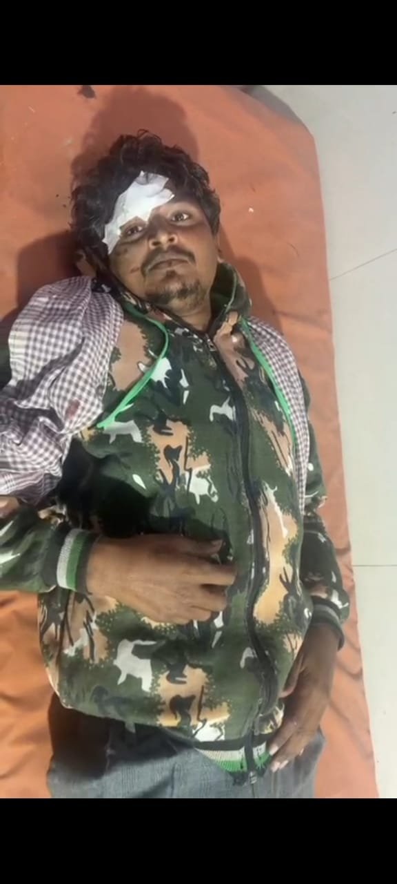 रायबरेली-अज्ञात बस की टक्कर से युवक गंभीर रूप से घायल