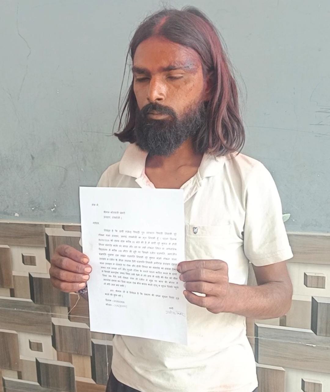 ऊंचाहार:होली मिलने के बहाने गले लगकर जकड़ा और करा दिया हमला,,,,,