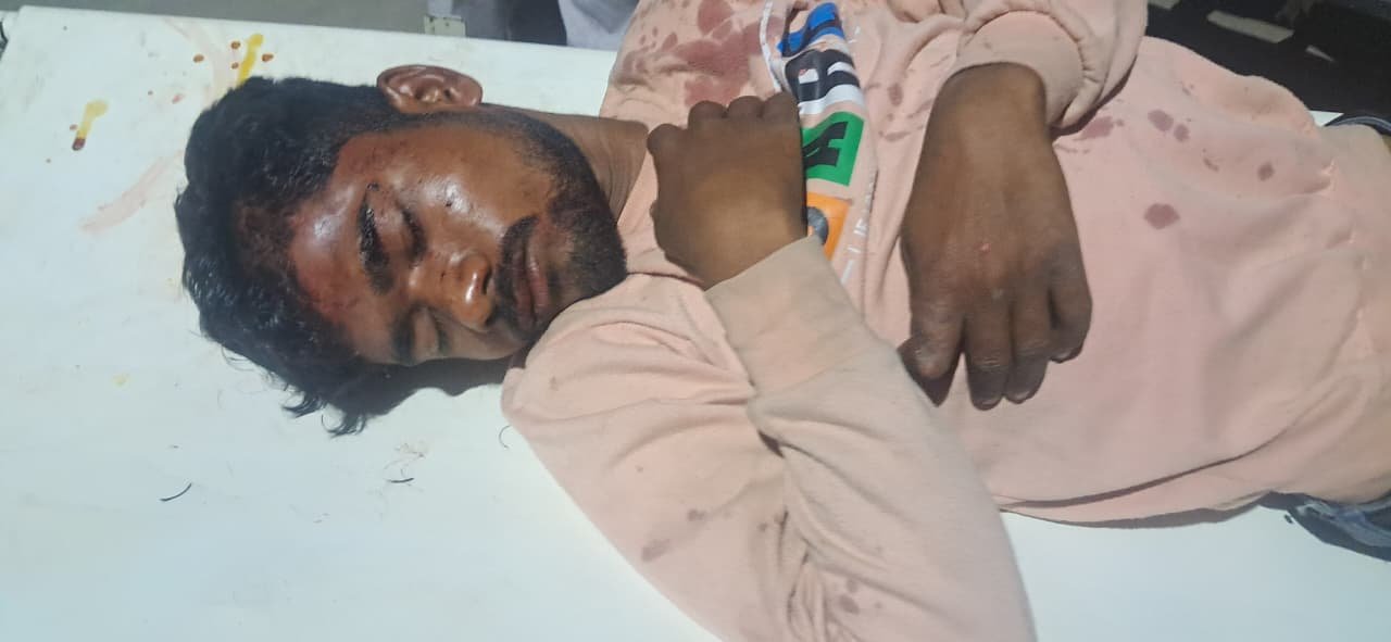 ऊंचाहार:शादी समारोह में युवक के साथ मारपीट, गंभीर हालत में जिला अस्पताल रेफर