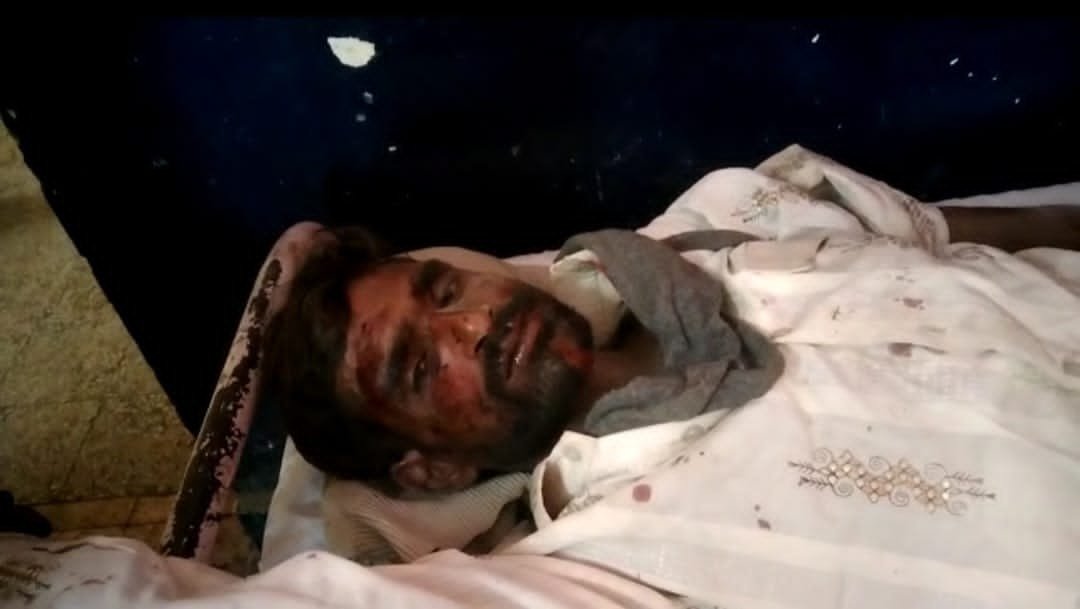 रायबरेली-सड़क हादसे में बाइक सवार गंभीर रूप से घायल हालत नाजुक