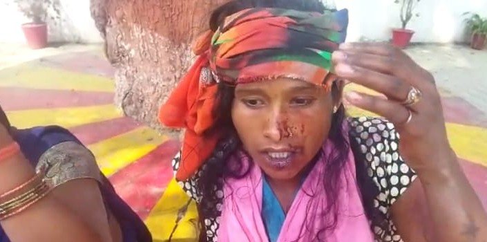 Raibareli-महुआ बिनने के विवाद में हुई मारपीट में महिला घायल