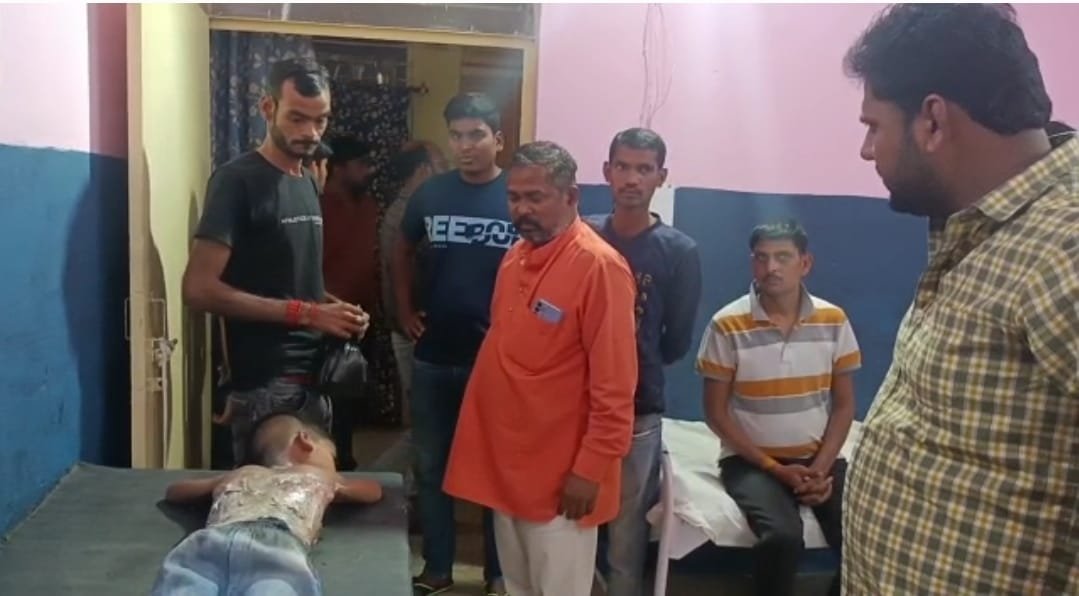 Raibareli-मंदिर में आरती के दीपक से झुलसा मासूम