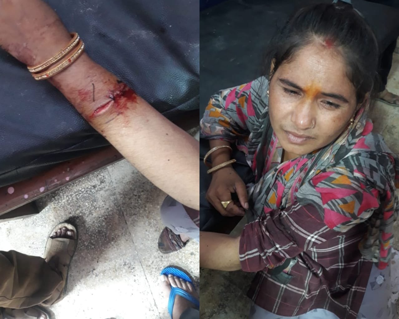 Raibareli-मोबाइल के विवाद को लेकर देवर ने भाभी पर किया जानलेवा हमला 