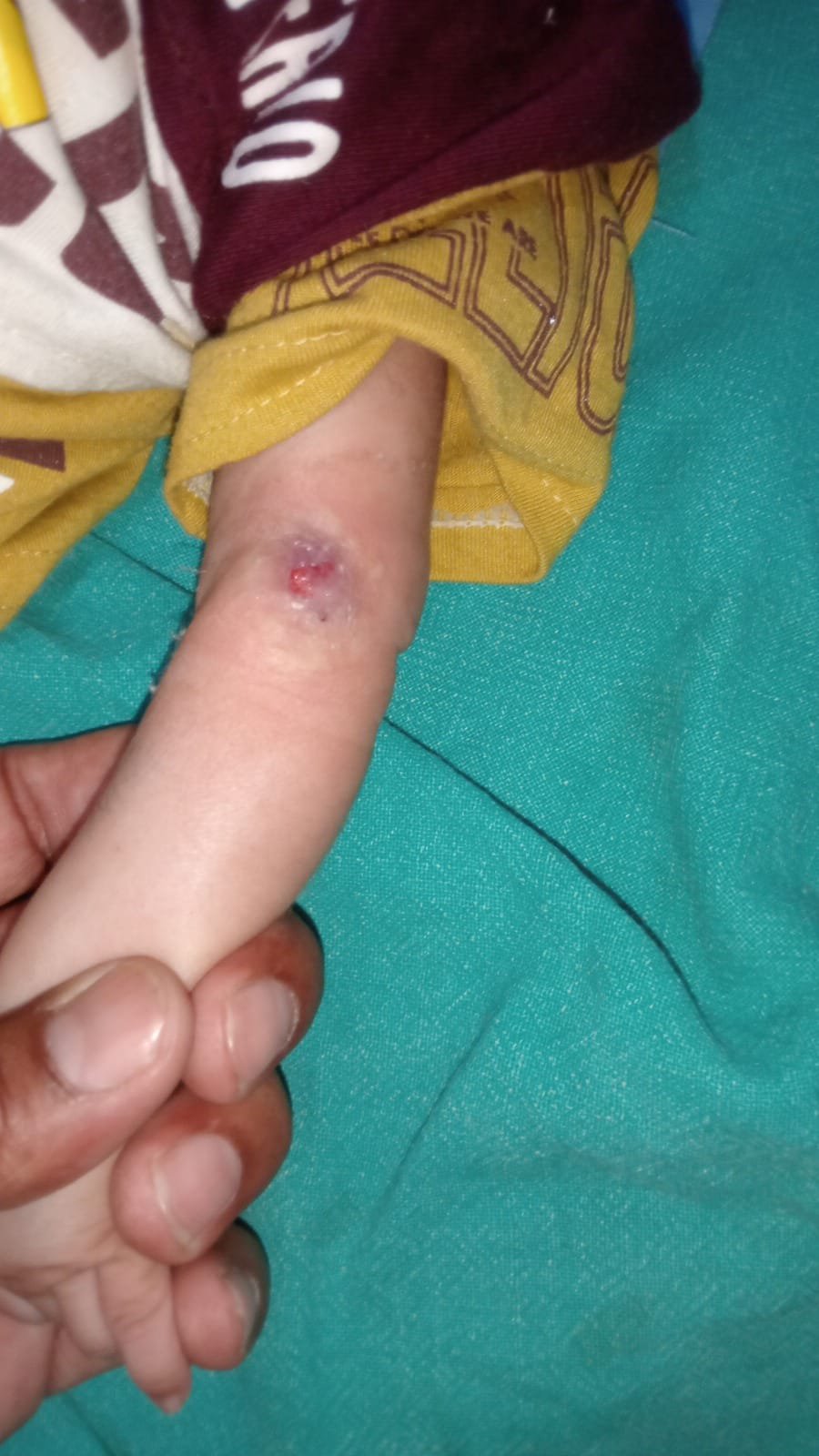 Raibareli-मरीजों को लूटने से बाज नहीं आ रहे रायबरेली के प्राइवेट हॉस्पिटल के डॉक्टर।