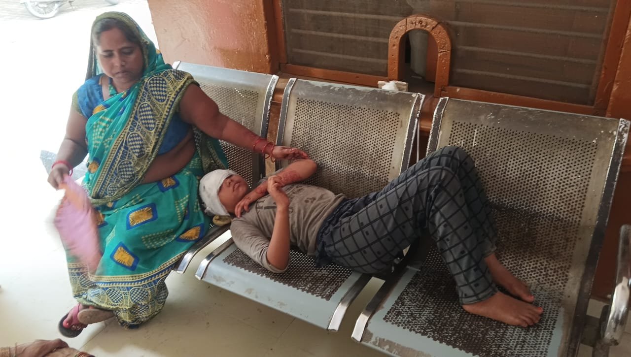 रायबरेली-पटाखे दागाते समय आग लगने से झुलसी मासूम बच्ची