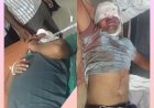 दो मोटरसाइकिलों की टक्कर में दो युवक गंभीर, लखनऊ ट्रामा सेंटर रेफर