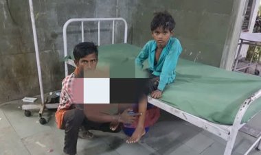 रायबरेली-नेवले का शिकार हुआ 8 वर्षीय बच्चा, किया गया इलाज