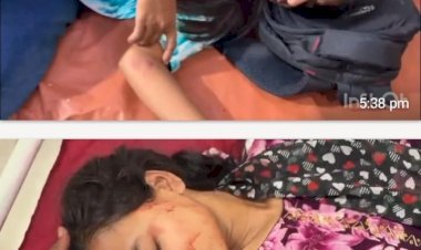 रायबरेली-स्कूटी का संतुलन बिगड़ने से कोचिंग पढ़ने जा रही दो छात्रा गिरकर घायल
