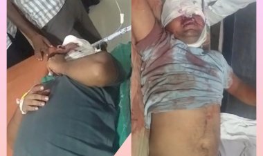 दो मोटरसाइकिलों की टक्कर में दो युवक गंभीर, लखनऊ ट्रामा सेंटर रेफर