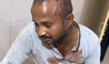 रायबरेली आपसी विवाद में युवक पर जानलेवा हमला, गंभीर घायल