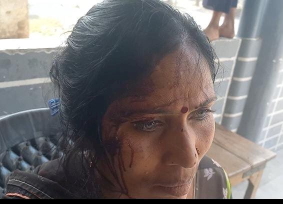 रायबरेली-महिला ने लगाया पड़ोसियों पर मारपीट का आरोप