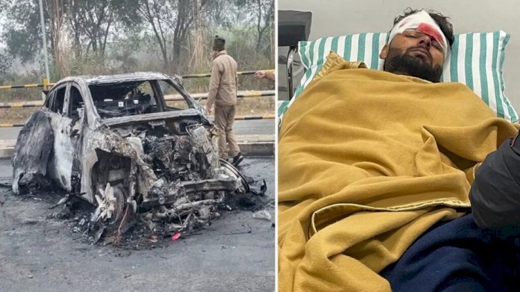 CM Dhami ने जाना क्रिकेटर ऋषभ पंत का हाल, कहा सरकार द्वारा वहन किया जायेगा इलाज का खर्चा !