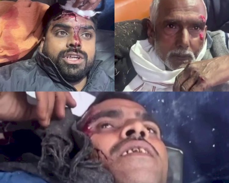 Raibareli-अलग-अलग दो मार्ग दुर्घटनाओं में तीन घायल 2 की हालत गंभीर