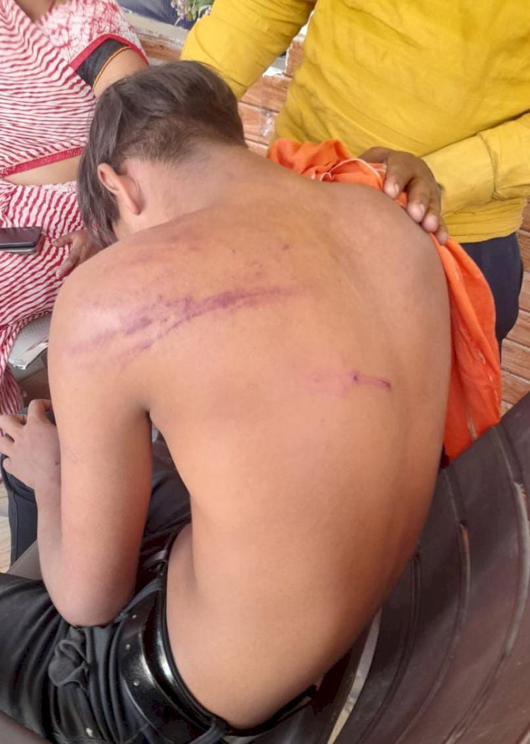 रायबरेली-पिता को खाना देने जा रहे बेटे पर घात लगाए बैठे दबंगो ने किया हमला,,,,