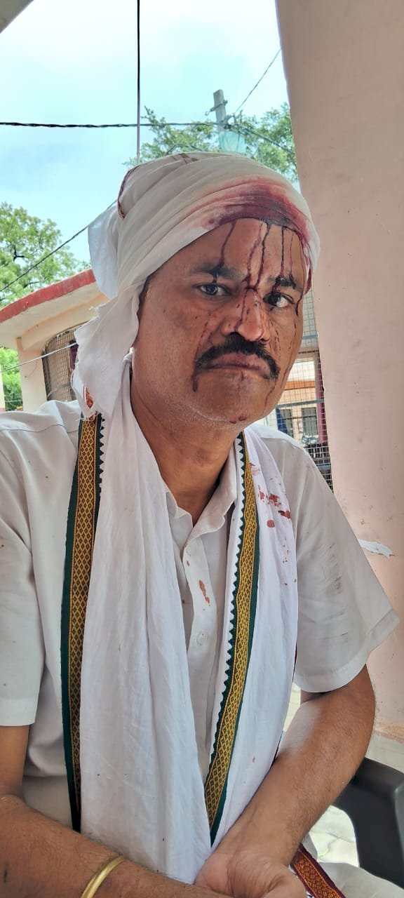 Raibareli-जान बचाकर भागे जीजा पहुंचे अस्पताल हुआ उपचार पुलिस ने लिया संज्ञान दर्ज हुआ एफआईआर