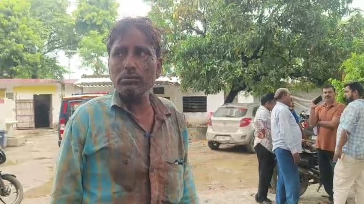 रायबरेली- सिर्फ नमस्ते करने पर छोटे भाई ने बड़े भाई पर ईंट से किया हमला घायल