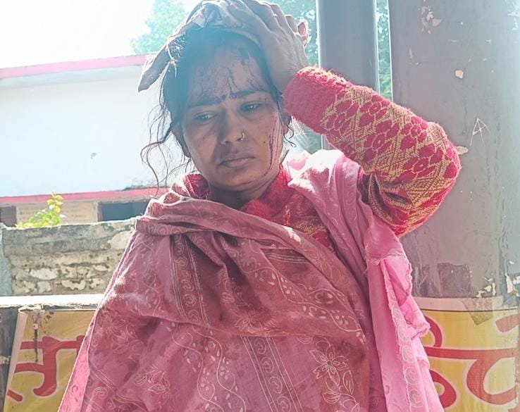 रायबरेली-घरेलू कलह के पति ने पत्नी को लाठी से पीटा, घायल