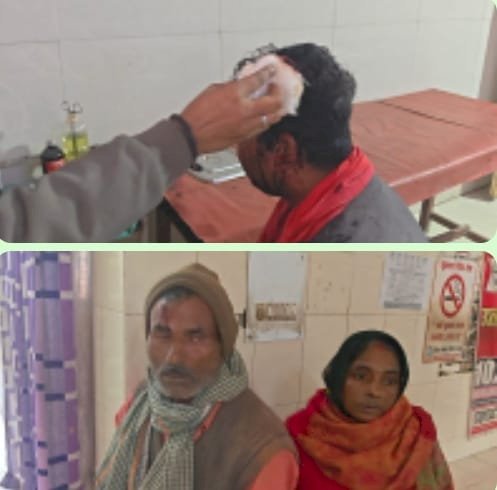 रायबरेली - मामूली बात को लेकर दो भाइयों के बीच हो रहे विवाद में चले लाठी-डंडे, तीन घायल