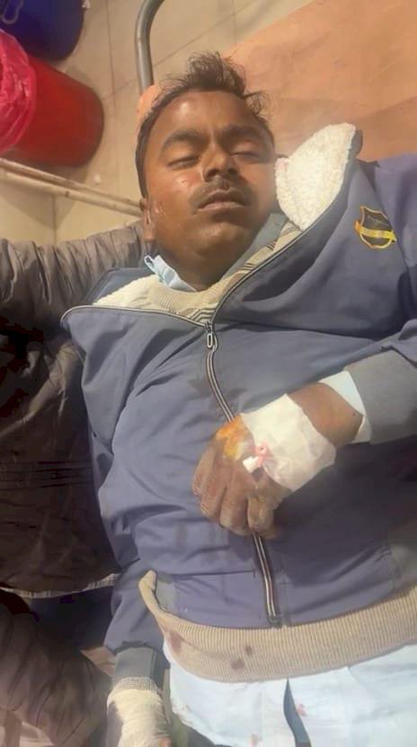 रायबरेली - अचानक सड़क पार कर रही नीलगाय से टकराया बाइक सवार, गंभीर रूप से हुआ घायल