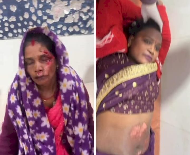 रायबरेली-टोल प्लाजा के निकट अज्ञात वाहन ने ई रिक्शा में मारी टक्कर, तीन महिलाएं घायल 