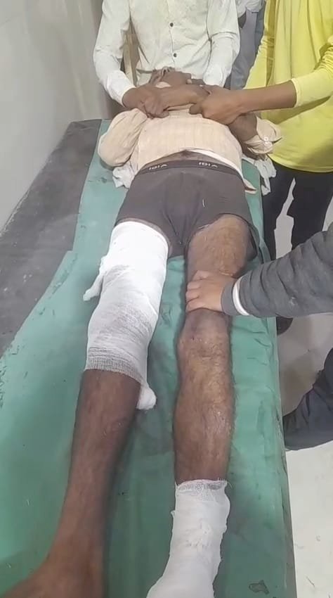 रायबरेली-अज्ञात वाहन की टक्कर से अधेड़ घायल, हालत गंभीर