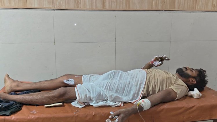रायबरेली-खंभे पर चढ़कर काम कर रहा कर्मचारी गंभीर रूप से झुलसा, लखनऊ ट्रामा सेंटर रेफर