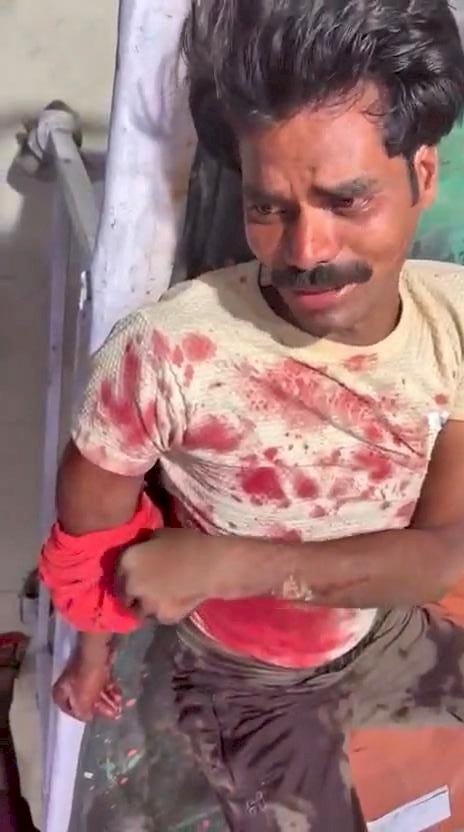 तेज रफ्तार अनियंत्रित डीसीएम व छोटा हाथी की हुई टक्कर, चालक गंभीर रूप से घायल
