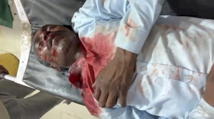 रायबरेली अज्ञात वाहन की टक्कर से बाइक सवार घायल, हालत गंभीर