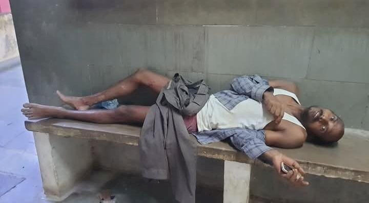 रायबरेली पागल सियार के हमले से 2 घायल, किया गया इलाज